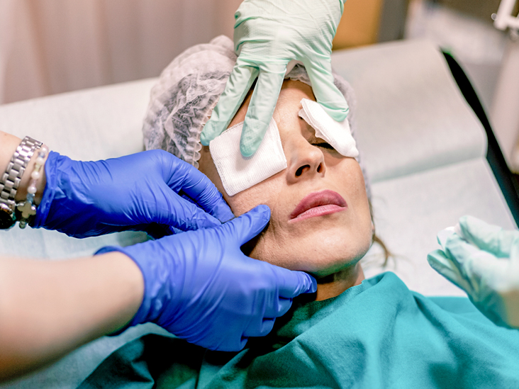 Things To Keep In Mind About Eye-Bag Removal Surgery