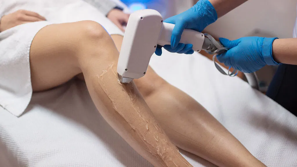 2 Chief Benefits of Laser Hair Removal