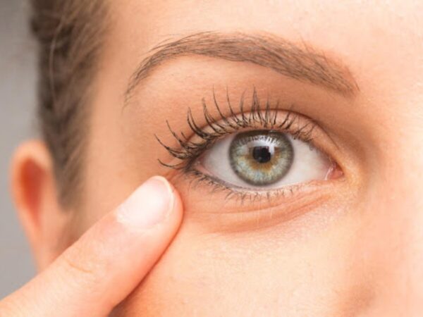 Understanding Dark Eye Circles and How to Banish Them